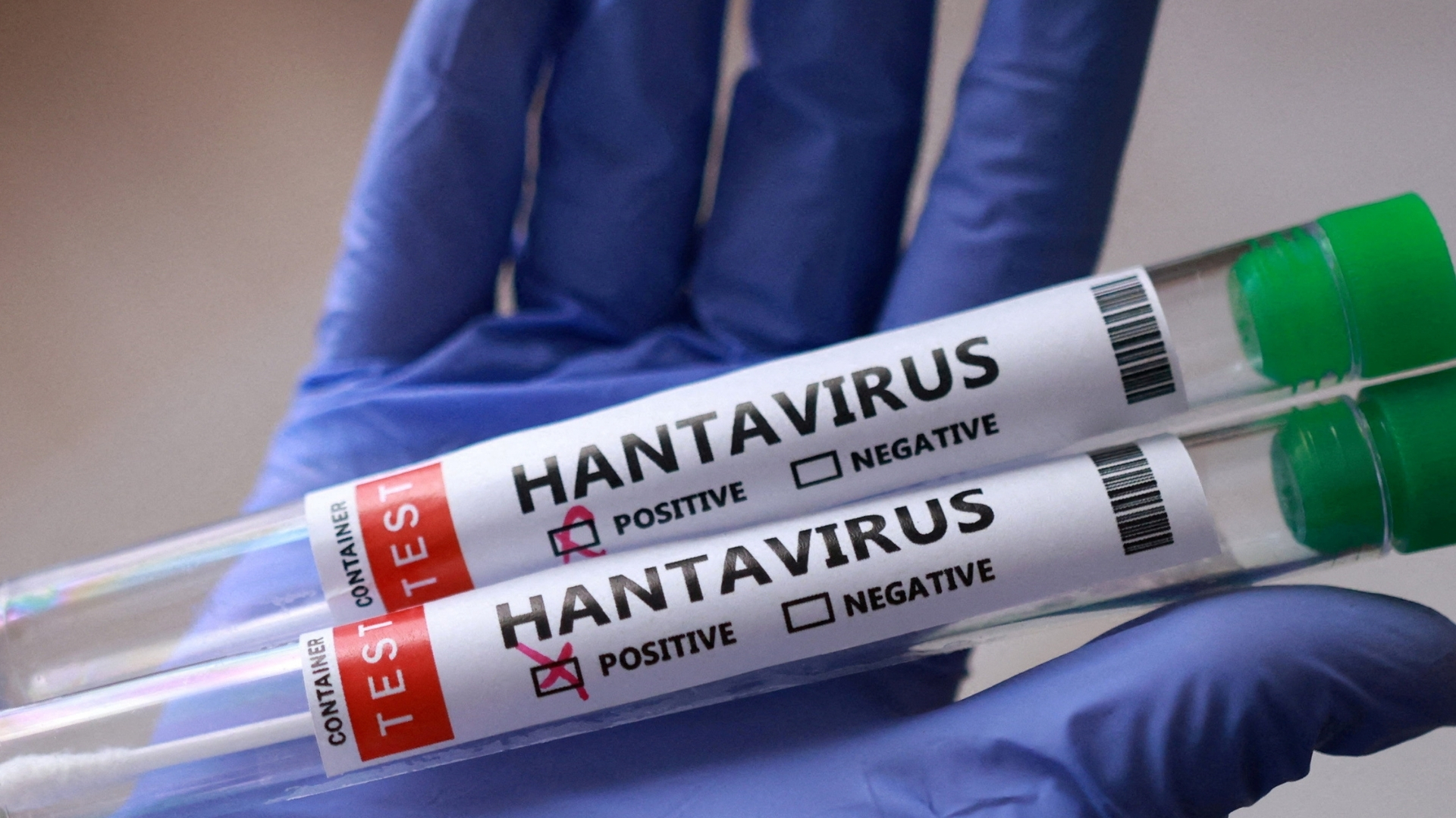 Hantavirus outbreak - Nguồn ảnh: aljazeera.com